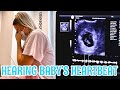 6 & 7 WEEK ULTRASOUND | Hearing Baby’s Heartbeat