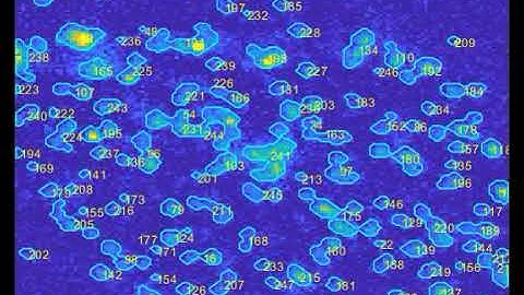 Cell-Segmentation and Tracking