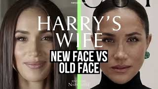 New Face Vs Old Face (Meghan Markle)