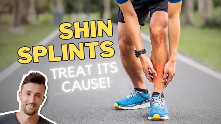 Shin Splints: 4 Exercises to Treat its Symptoms & Underlying Cause