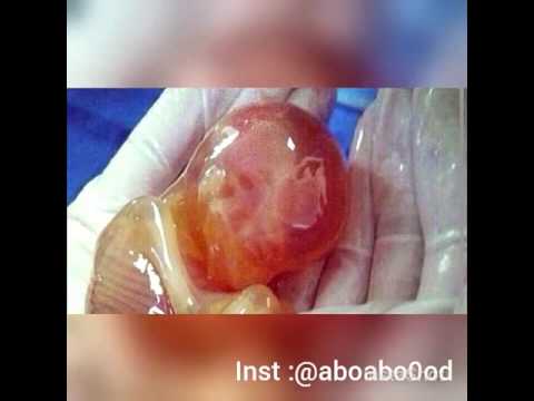 اوانه ی که دژایه تی په روه ردگار اکه ن باهه ولی به ده ست هینانی نه مری بده ن