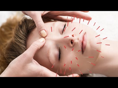 Иглотерапия М.Люблино Эльклиника+79250564956
