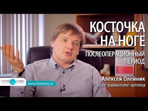ВАЛЬГУСНАЯ ДЕФОРМАЦИЯ (HALLUX VALGUS) послеоперационный период после удаления косточек на ногах