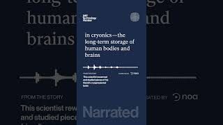 This scientist rewarmed and studied pieces of his friend’s cryopreserved brain