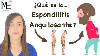 Hablemos de la Espondilitis Anquilosante - sus síntomas y características generales!