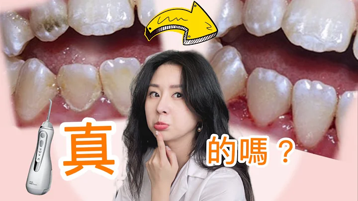 [你误解 冲牙机了]  真的需要买吗？牙医示范如何正确使用！ - 天天要闻