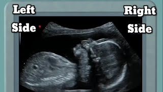 Fetal Situs and Fetal Presentation