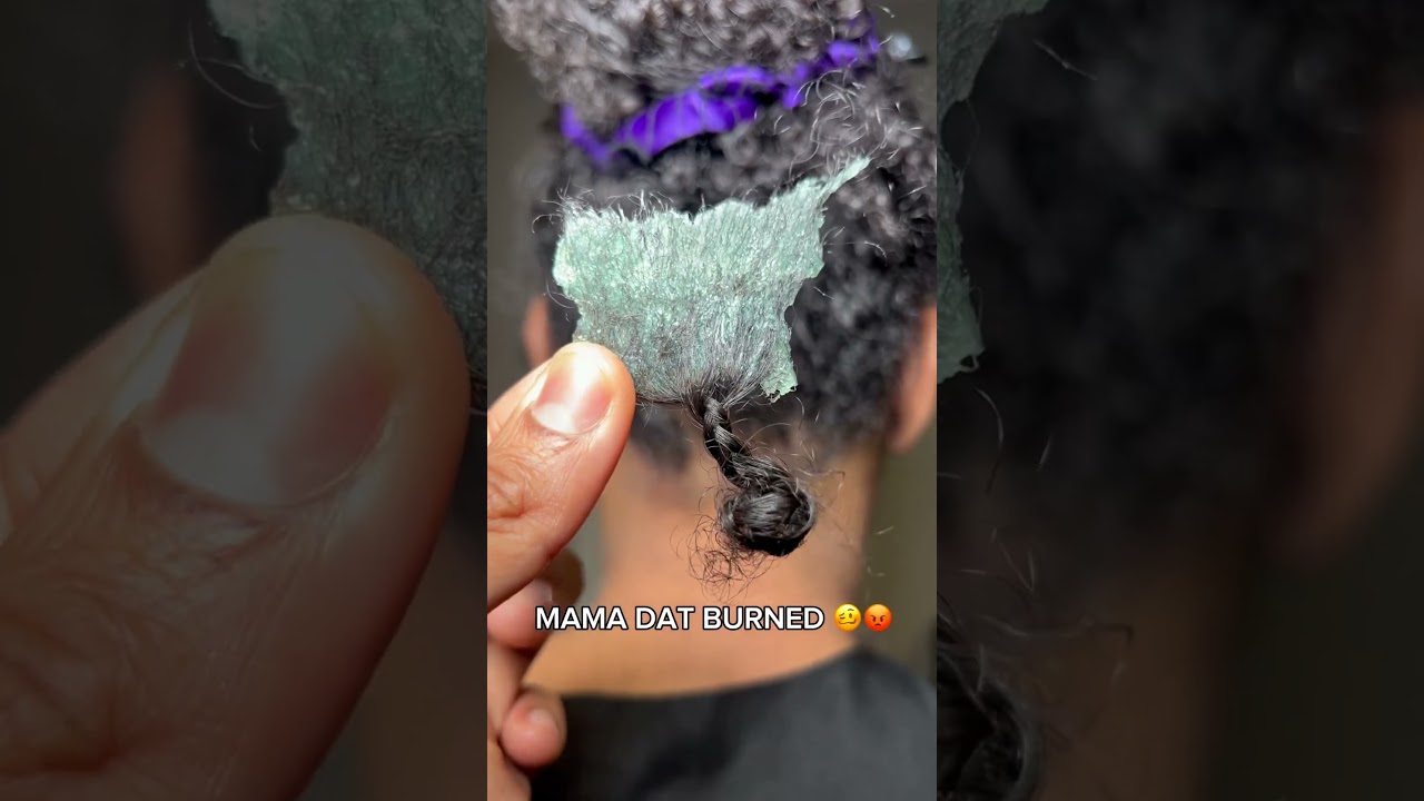 mama dat BURNED 😮‍💨🤬