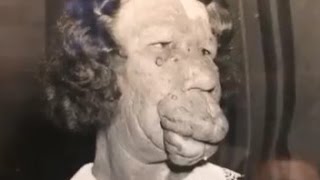 閲覧注意 最も醜い女 としてサーカスのフリークショーに出た女の生き様がスゴイ Youtube