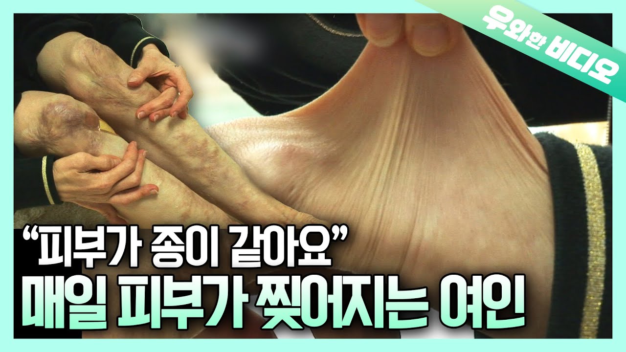 Неспособность регенерировать в течение 40 лет, и ее секрет раскрыт