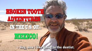 Broken Tooth Adventures in the U.S. of... MEXICO - Affordable Quality Dental Work in North America