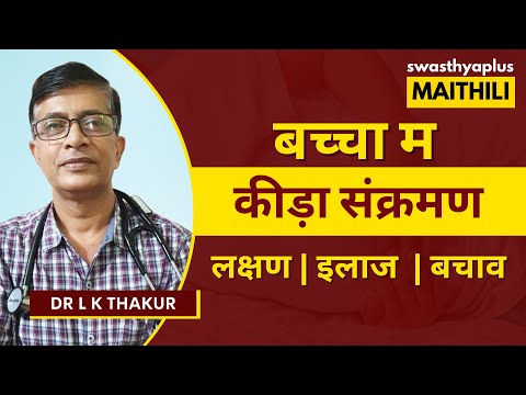 बच्चा म कीड़ा संक्रमण के लक्षण की छै? | Worm Infection in Kids, in Maithili | Dr L K Thakur