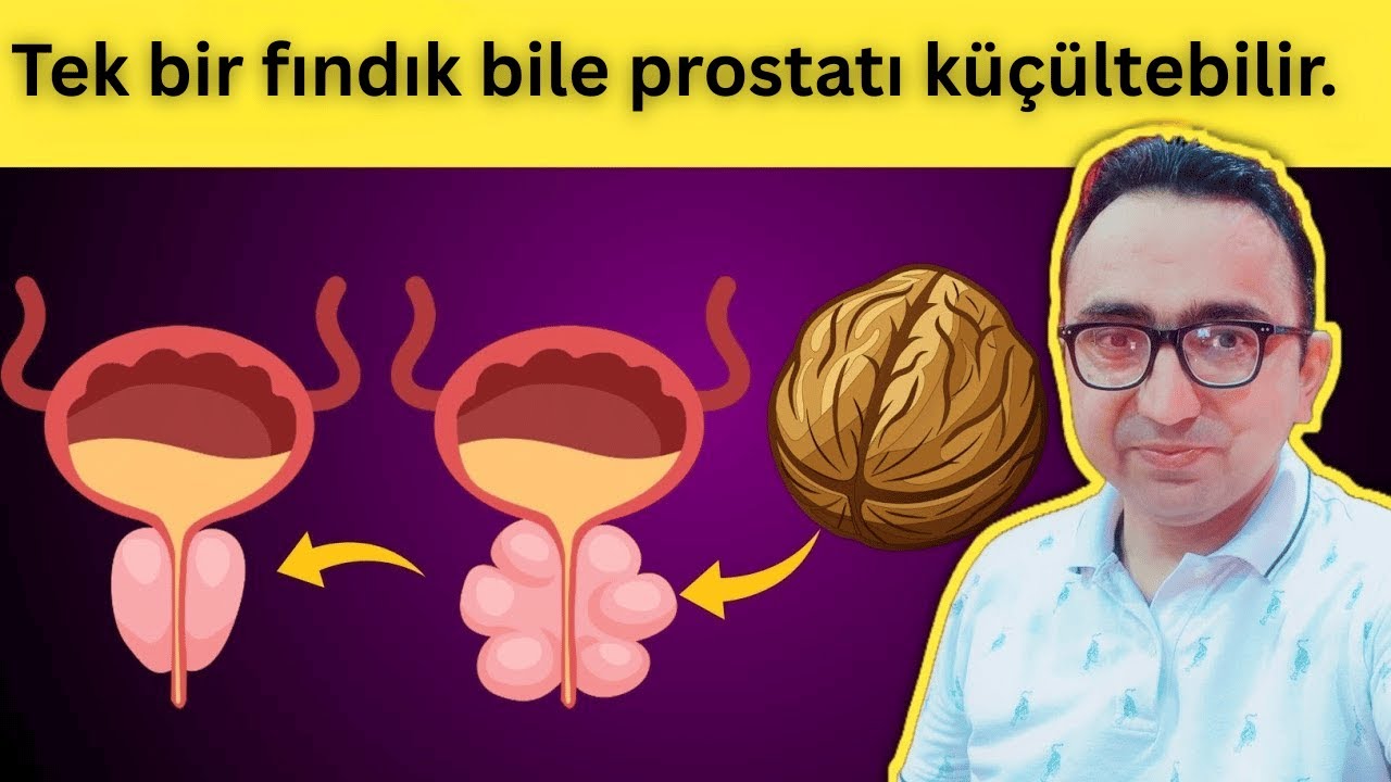 Sadece BİR Fındık Prostatınızın Büyümesini Azaltır .