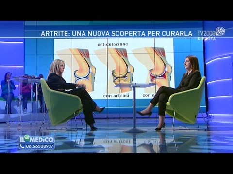 Artrite: una nuova scoperta per curarla