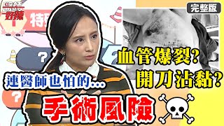 手術沾黏風險高！各科醫師都畏懼？！【#醫師好辣】20210408 完整版 手術風險 EP1129 鄭丞傑 田知學