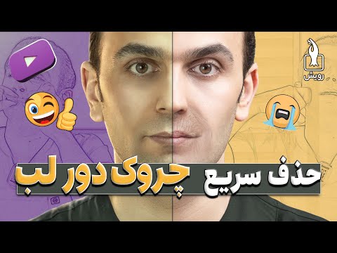 حذف چروک دور لب روشی بهتر از بوتاکس