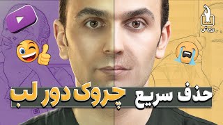 حذف چروک دور لب | روشی بهتر از بوتاکس