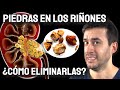 ¿PIEDRAS en LOS RIÑONES? MIRA ESTO!