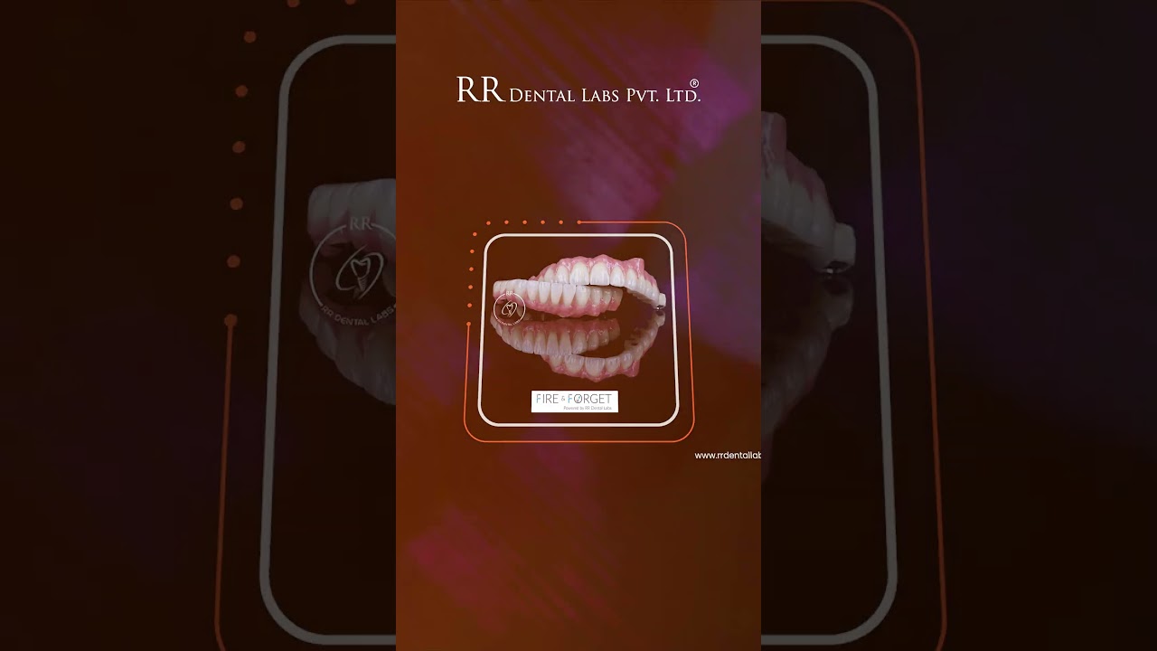 RR Dental Labs  Fire & Forget Implants & I-Dent Aligners  Digital Dental Innovation in India