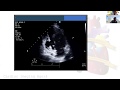 Echocardiography in identifying mechanical complications of myocardial infarction: Venu Menon, MD