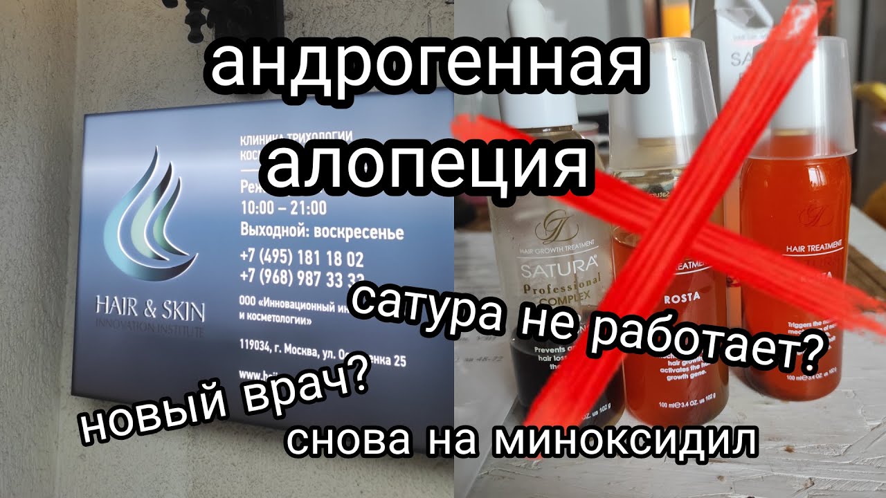 Андрогенная алопеция | новый врач вернул миноксидил - YouTube