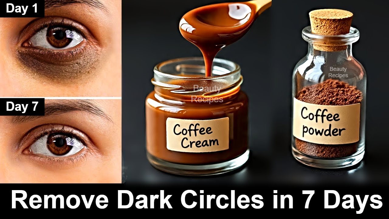 i Removed DARK CIRCLES in 7 Days | Under Eye WRINKLES, Eye Bags - Coffee Eye Mask & Coffee Eye Gel