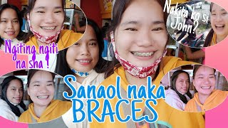 NAKA BRACES NA DIN SIYA (Sanaol nalang talaga)