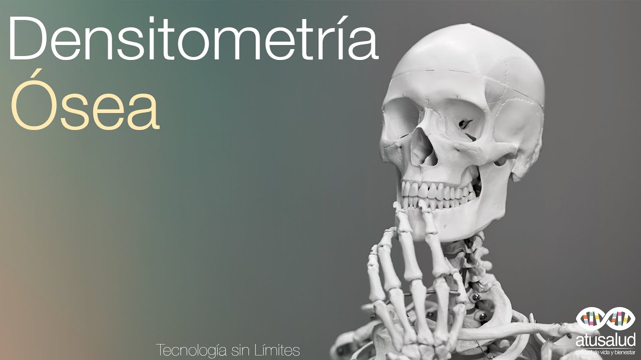 guia practica clinica sobre osteoporosis prevencion fracturas por fragilidad