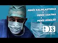 Penis uzatma  penis kalnlatrma ameliyat  penis erilii 