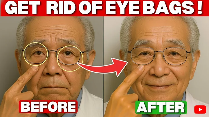 Japan’s Oldest Doctor: The ONLY Way Seniors Can Get Rid of Puffy Eyes for GOOD