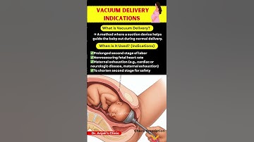 Vacuum Birth? Here’s What Really Happens During Delivery | Vacuum Delivery in Childbirth