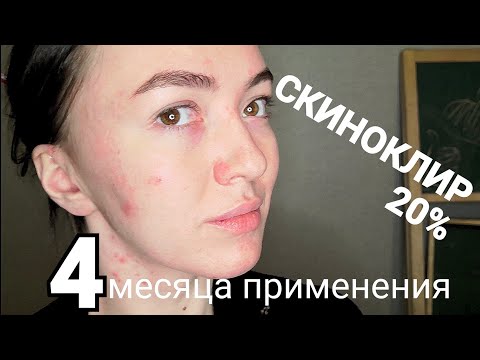 Скиноклир до и после отзывы