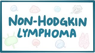 Nonhodgkin lymphoma  causes, symptoms, diagnosis, treatment, pathology