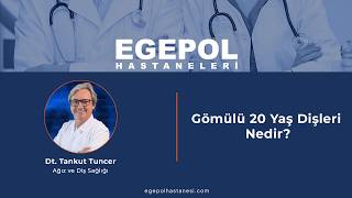 Gömülü 20 Yaş Dişleri Nedir? | Belirtileri ve Tedavisi | Diş Hekimi Tankut Tuncer