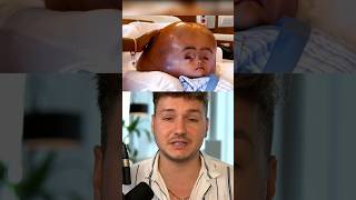 Menschen Mit Den Größten Körperteilen Der Welt