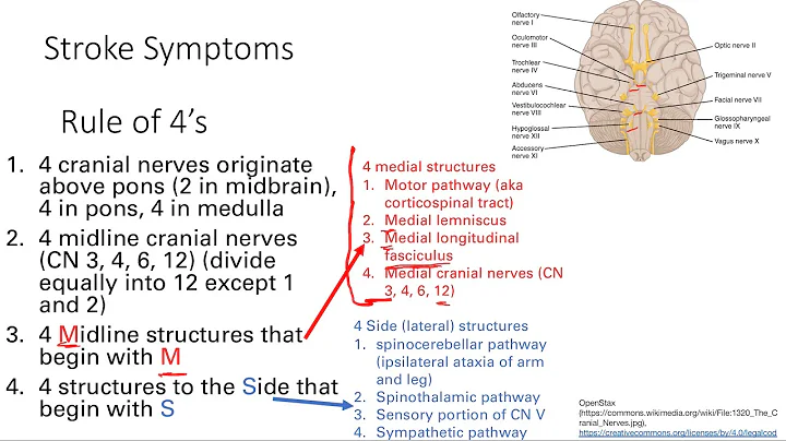 Stroke Rule Of 4's | Nervous system | Step 1 Simplified