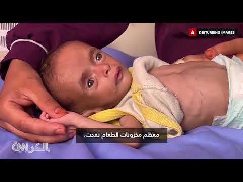 أزمة الجوع في غزة: تقارير تتهم إسرائيل بالمسؤولية