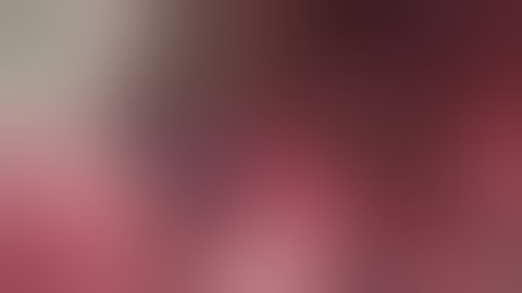 Isolated caudate lobe lobectomy