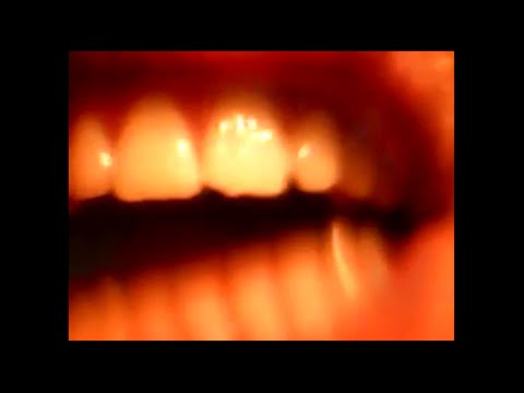 HUGO REMMEN - GHILLIE REMIX