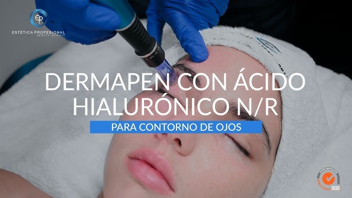 Ampolla con vitamina C para su aplicación directamente en la cara para el  procedimiento de mesoterapia con la ayuda de dermapen, aplicación de  líquido a la f Fotografía de stock - Alamy