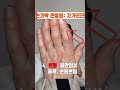 유앤제이병원 손가락관절염 자가진단