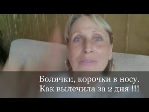 Корочки, Болячки, Сухость в носу. Как вылечить за 2 дня !!!