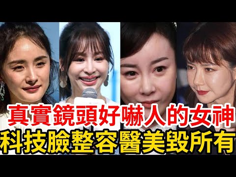 整容用力過猛，美女變身整容怪， 直接毁容一上鏡臉僵臉垮，導致無戲可拍，斷送前程！#杨幂#张檬#戚薇#娄艺潇#蔡明