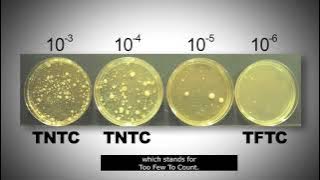 Standard plate count