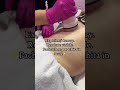 Salon Aanes Cosmetics Mamaia Nord  #beauty_salon #skincare #tratament #cosmetic  #nanoplastia