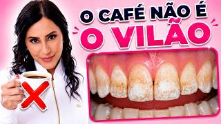 Manchas nos Dentes - O diagnóstico ESCONDIDO que MUDA TUDO Manchas nos Dentes - O diagnóstico ESCONDIDO que MUDA TUDO