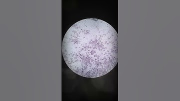 Ascitic fluid slide 40 up.