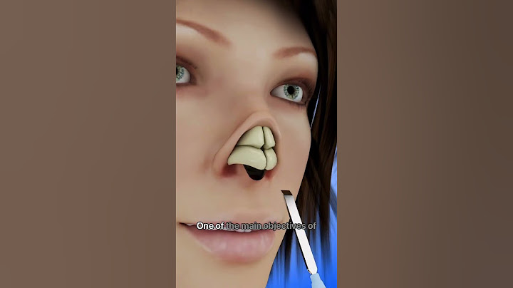 Transform Your Nose with Rhinoplasty #shorts - Creativelearning3d