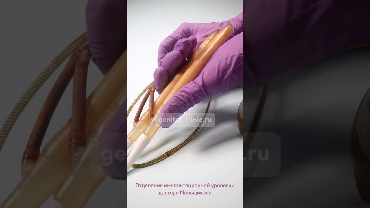 AMS 700 LGX от Boston Scientific / полный обзор протеза