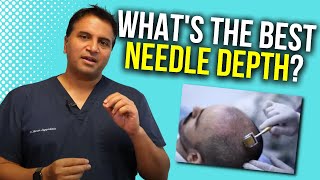 Derma-rolling: Optimal Needle Depth | The Hair Loss Show